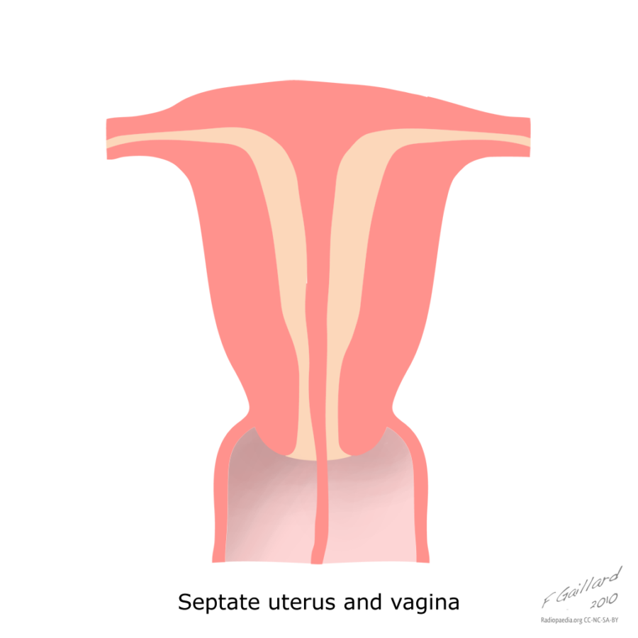 cervix diagram blank