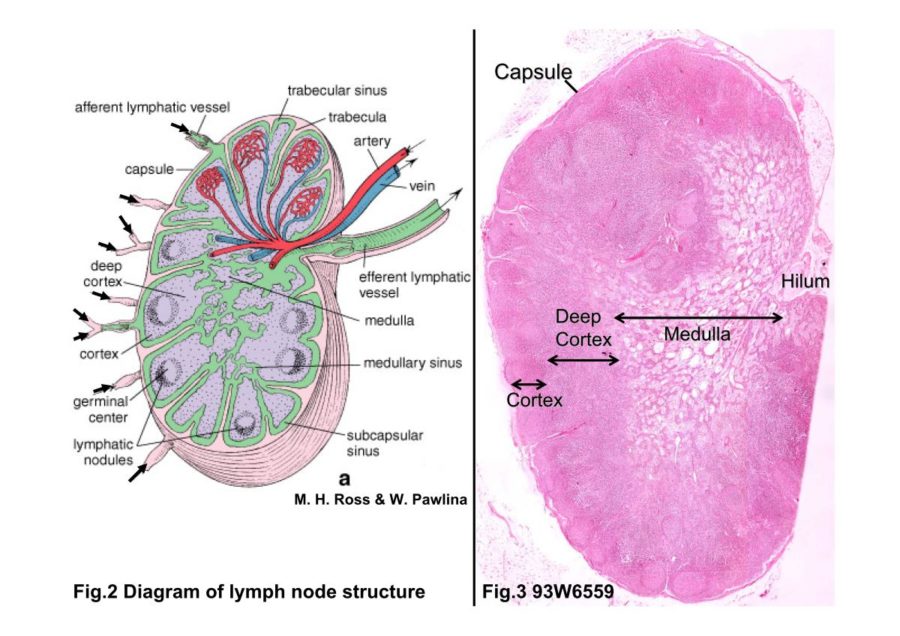 diagram of lymph nodes shaped