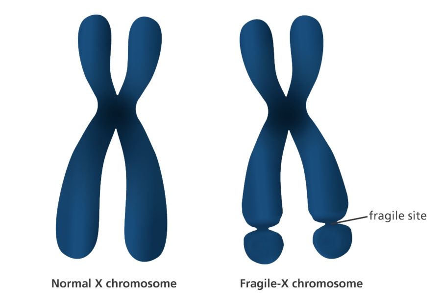 chromosome diagram fragile