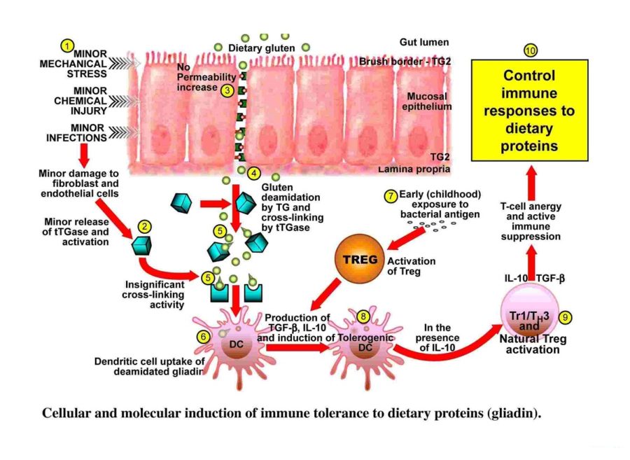 immune system diagram page